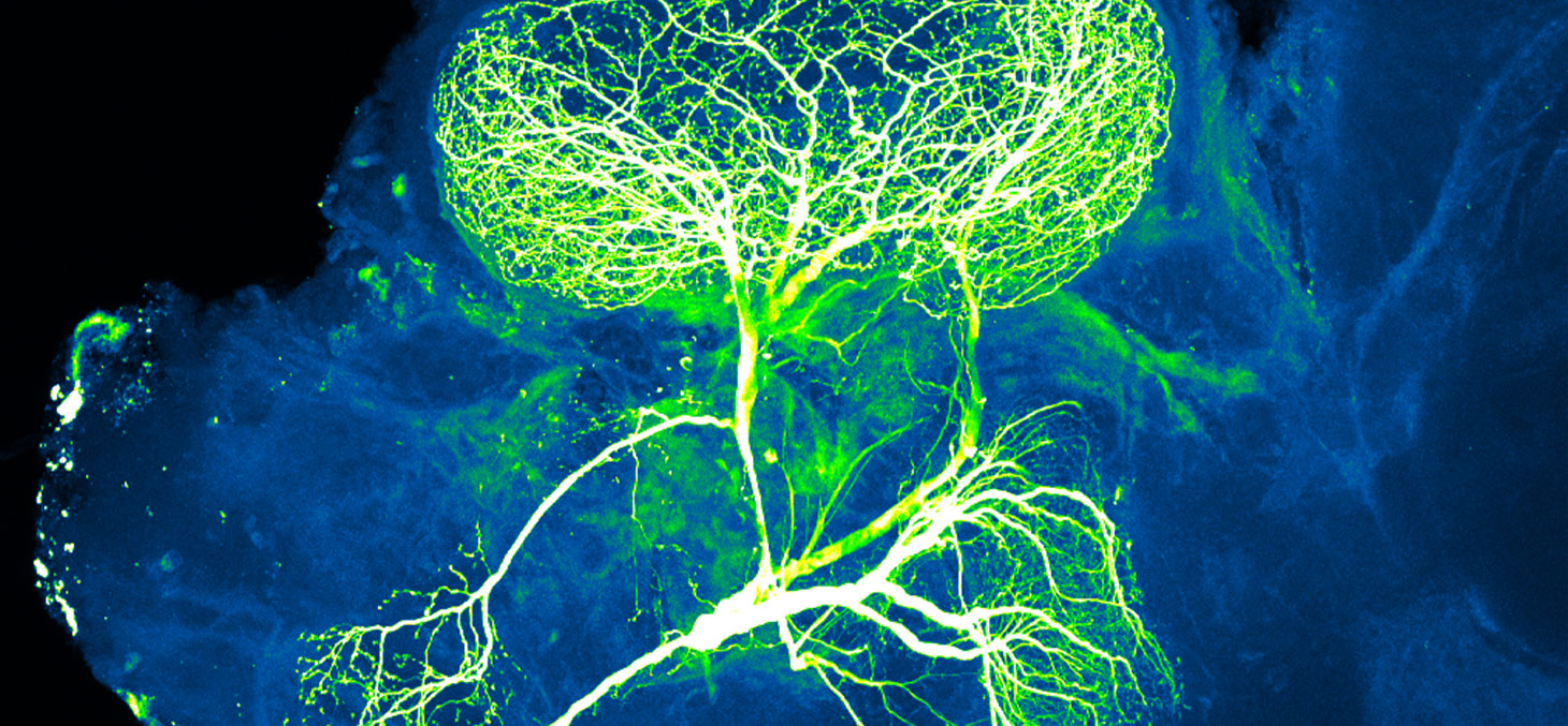 Un neurone (en vert et en blanc) dans le cerveau d'un insecte. Le défi consiste à faire repousser l'axone du neurone quand celui-ci a été lésé, par exemple dans un accident touchant la colonne vertébrale. NICHD/N © Gupta, CC BY-SA